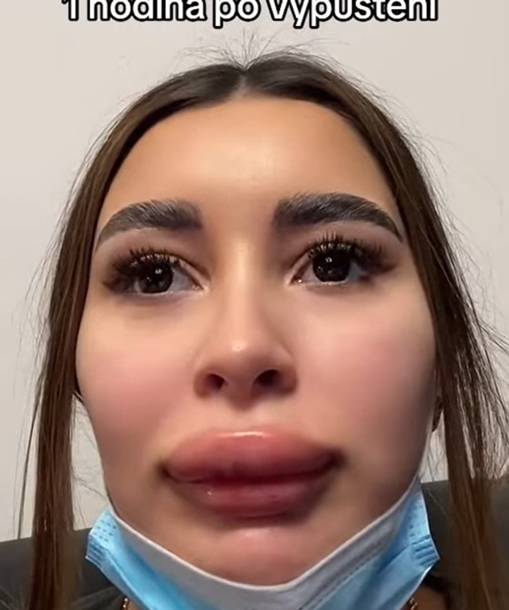 Karolína Shawty (1)