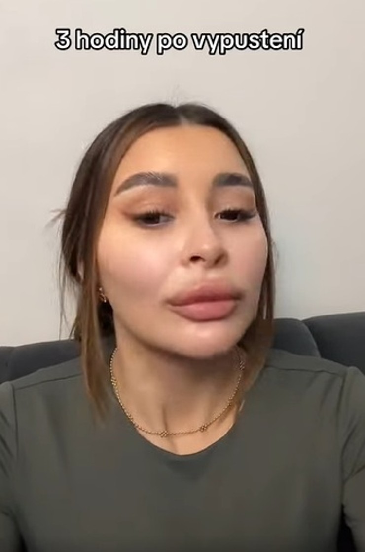 Karolína Shawty (2)