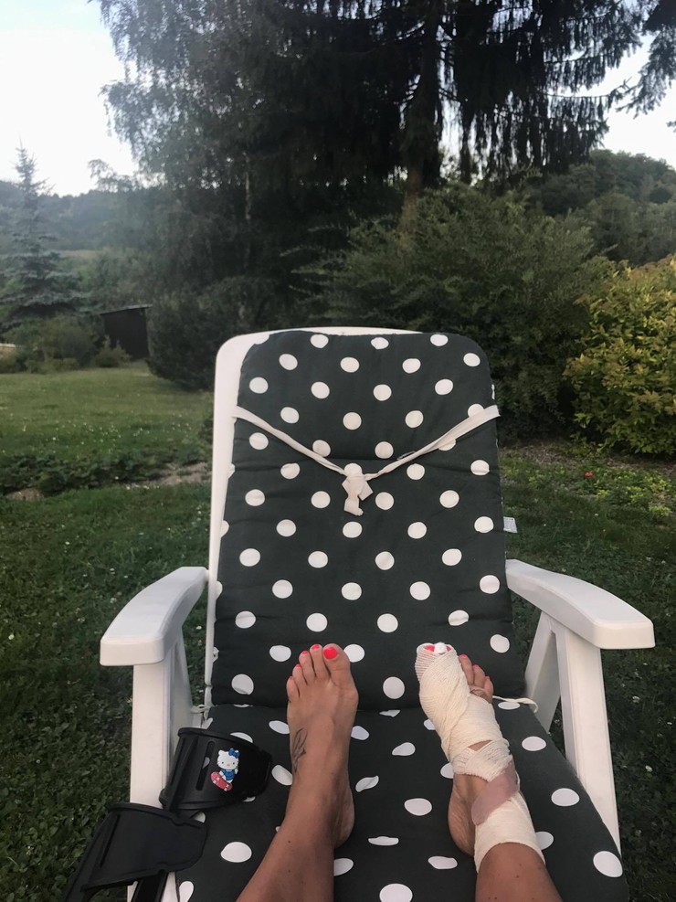 Moja mama - Zuzka Sabolová sa vrátila z dovolenky so zlomeninou