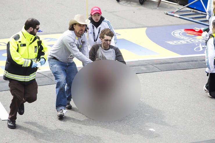 Jeff Bauman z Bostonského maratónu v skutočnosti