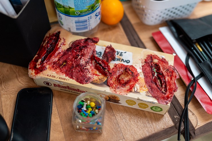 Nemocnica - tvorba zranení