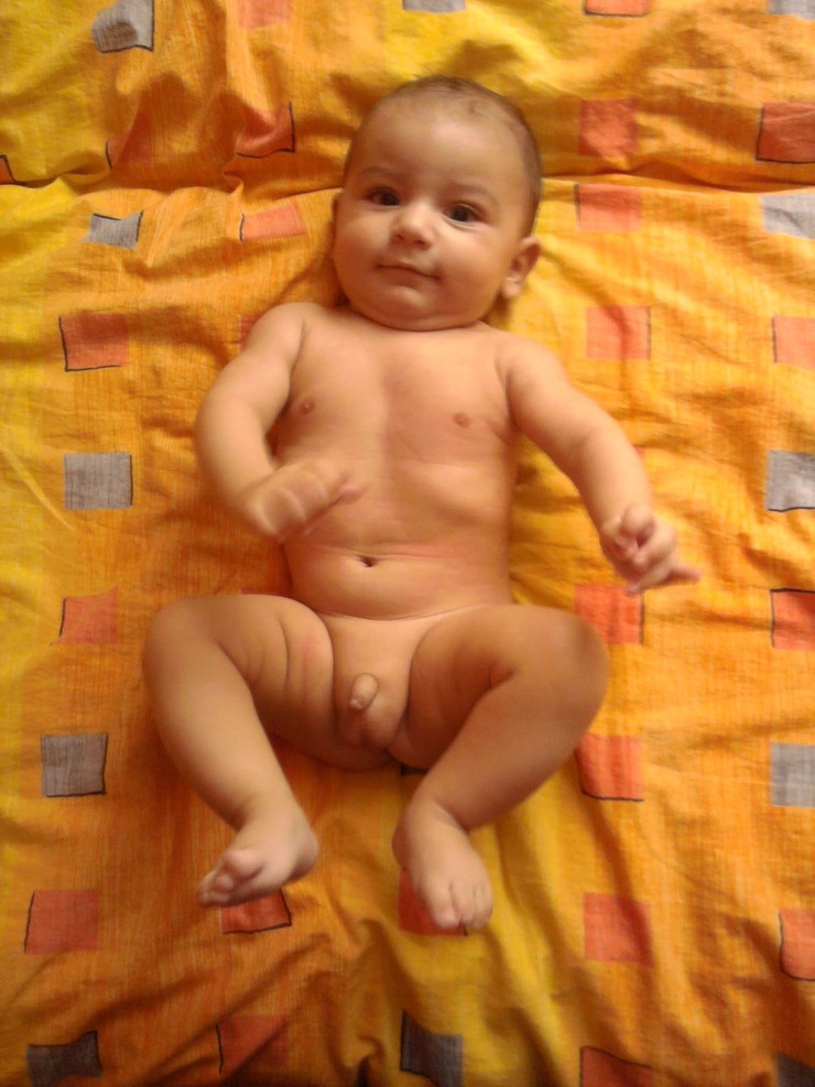 Tobiasko