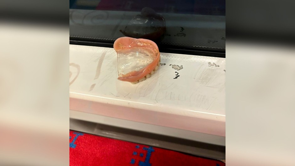 zubná protéza električka