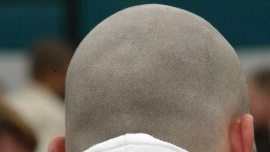 neonacista-hlava-zozadu