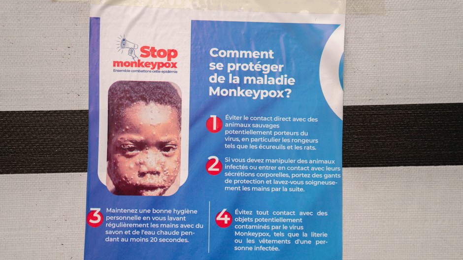 Opičie kiahne v Afrike