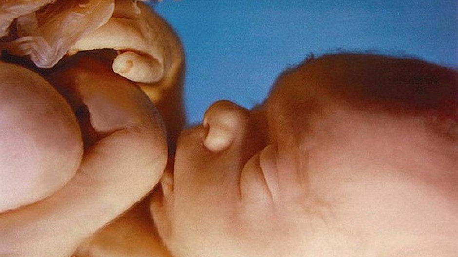 Plod, dieťa, celok, 23 týždňov