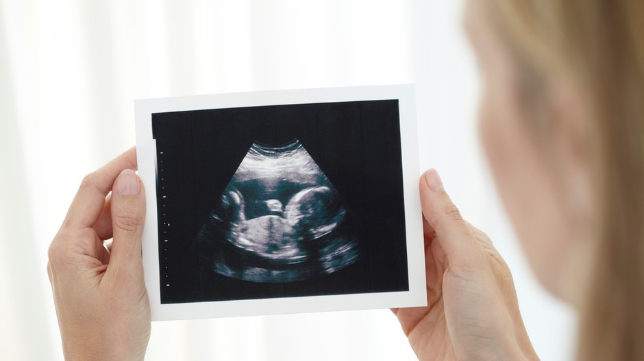 Žena_ultrazvuk_interrupcia