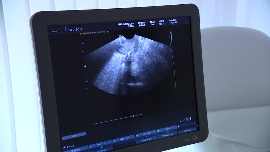 [multi] Poslanci napriek ekonomickej kríze riešia interupcie 8686