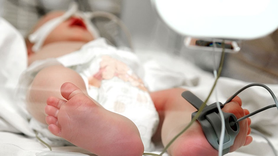 Hranica prežitia je 24. gestačný týždeň, čo je šiesty mesiac tehotenstva,“ hovorí doktorka z Kliniky detskej pneumológie - Jaroslava Orosová.