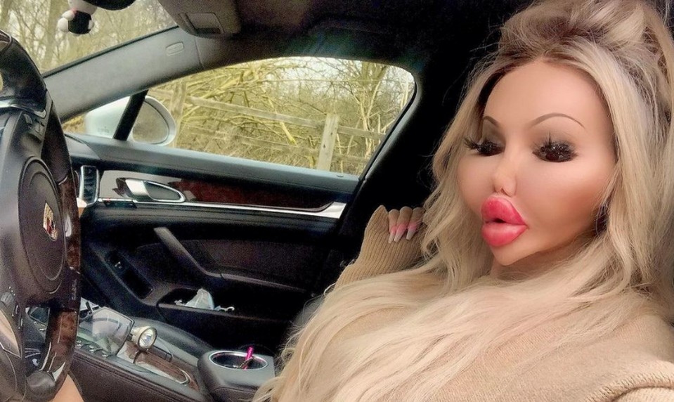 Žena "vďaka" plastikám nepripomína ČLOVEKA!